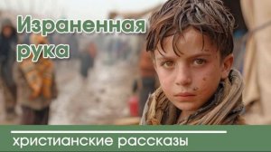 Израненная рука - ИНТЕРЕСНЫЙ ХРИСТИАНСКИЙ РАССКАЗ | Христианские рассказы