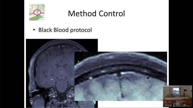 Complex System And Future Technologies In Neuroscience_CSFTN’25 Part 1
