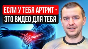 тучи артрита rm