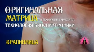 Крапивница ⚠️ Оригинальная программа матрица по технологии Гаряева П.П ☀️ SoftRadio.ru