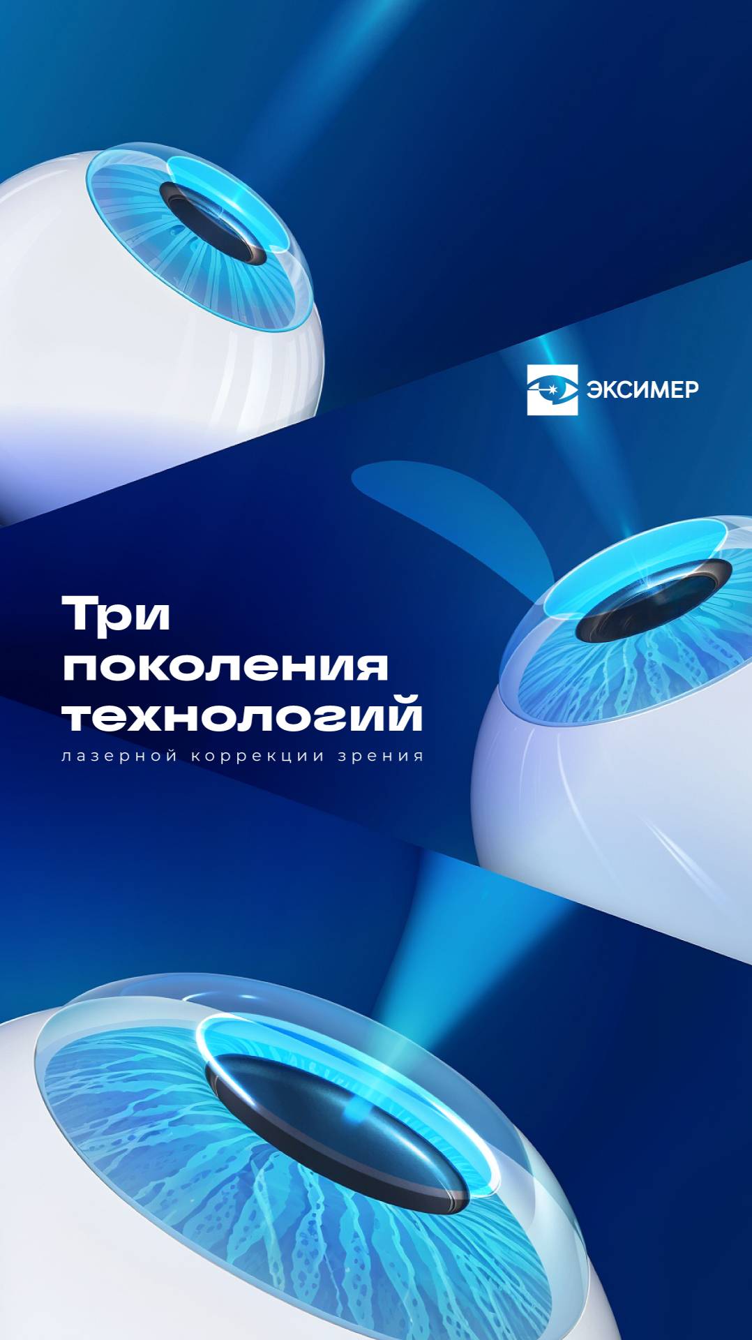Методы лазерной коррекции зрения в Эксимер. смотреть онлайн