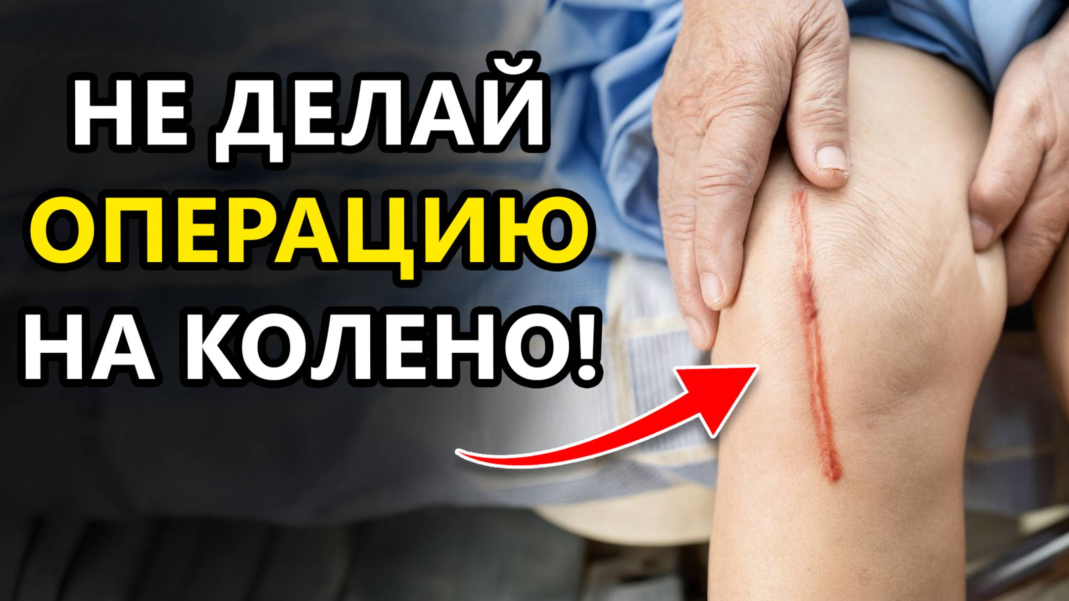 Быстрый тест: нужна ли вам операция на колено? Ужасные последствия ненужной операции смотреть онлайн