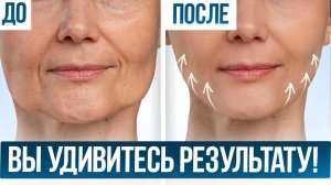 Как подтянуть лицо БЕЗ ОПЕРАЦИИ за 10 минут в день? 7 простых упражнений
