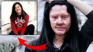 ИСТОРИЯ ЛЖЕХИРУРГА УРОДОВАВШЕГО СВОИХ ПАЦИЕНТОВ