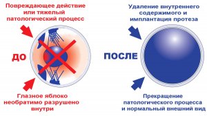 Другая офтальмология. Выпуск 6. Интраокулярное протезирование у животных