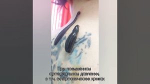 Постановка пиявок на шейно-воротниковую зону