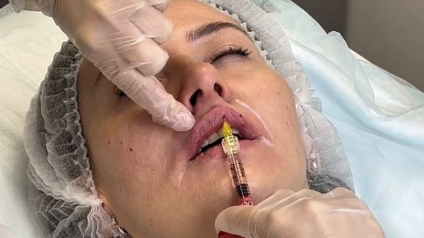 Мастер-класс Д.Н. Пермяковой Regenyal Idea Lips