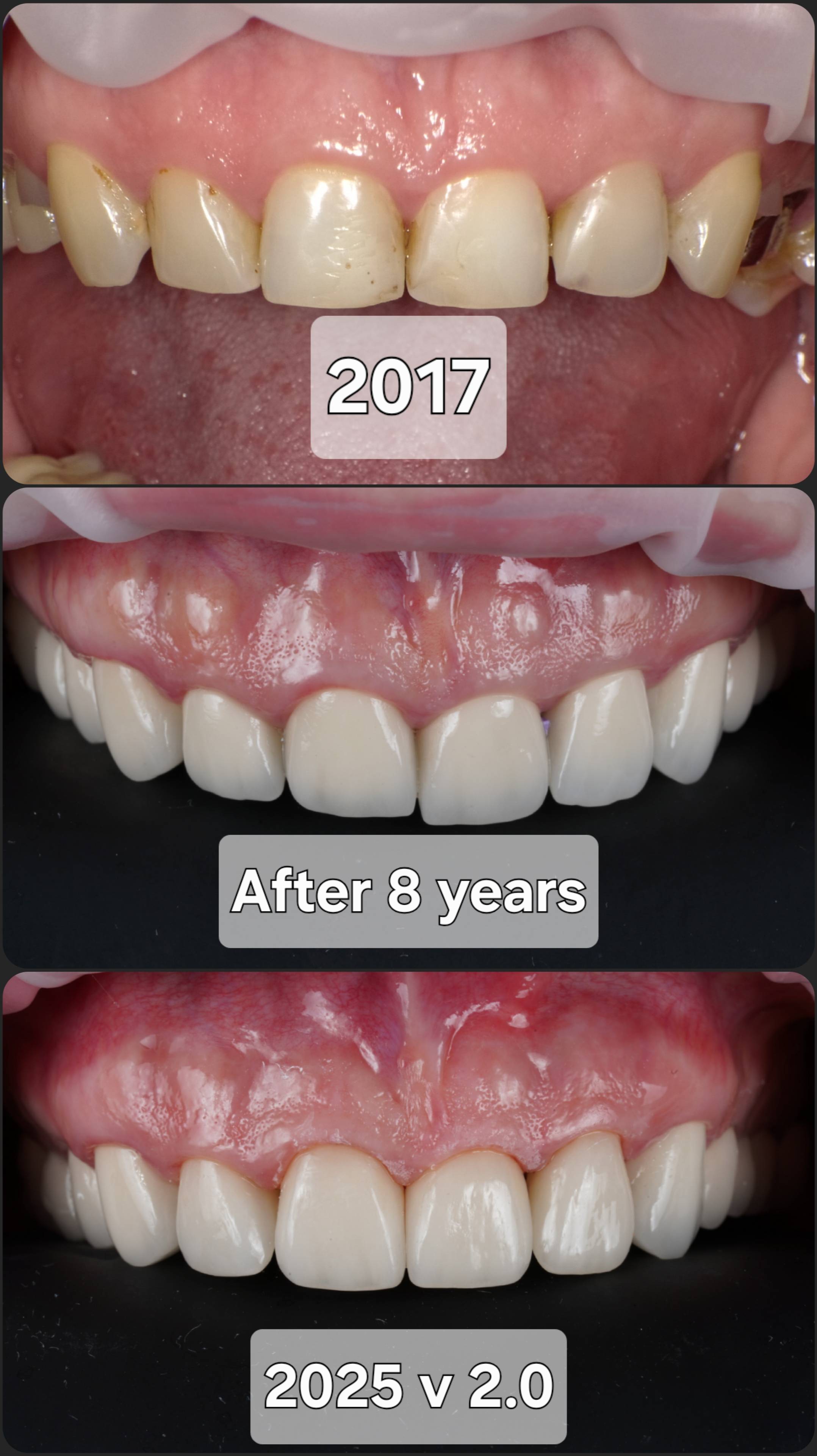 UPGRADE СВОЕЙ ЖЕ РАБОТЫ