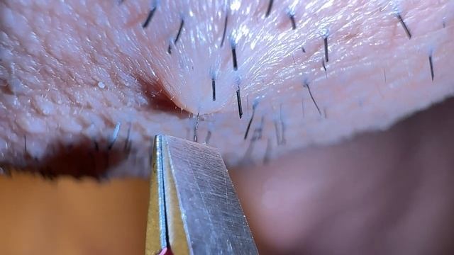 Удаление волос смотреть онлайн