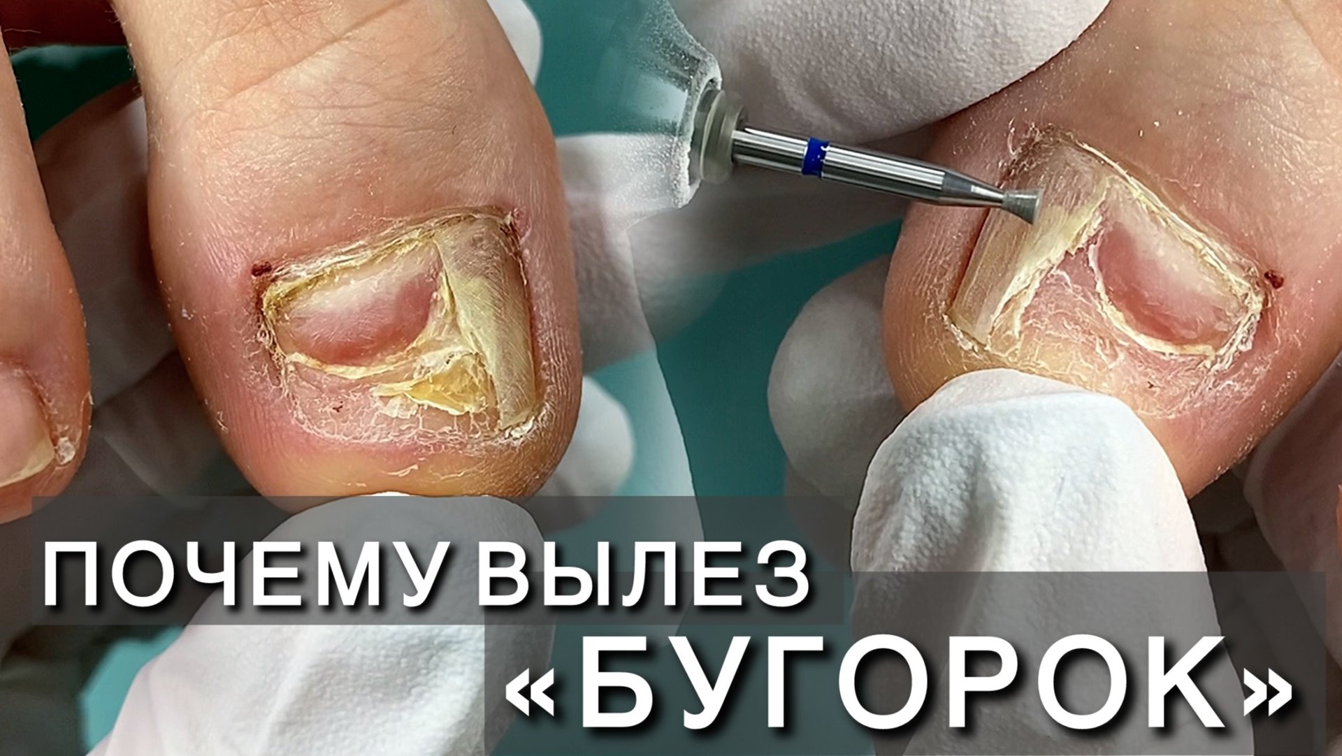 Прищемила смотреть онлайн