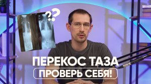 3 признака ПЕРЕКОСА ТАЗА — вот что делать! + Эффективные упражнения