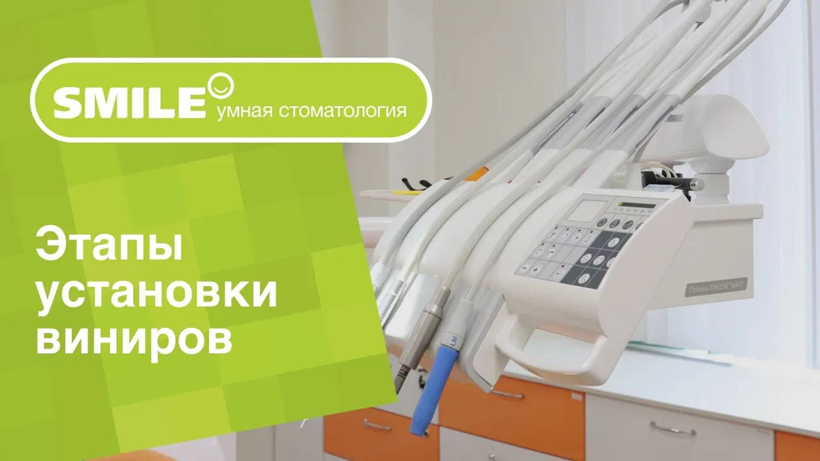 🔎 Из каких этапов состоит установка виниров