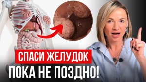 Самые БЫСТРЫЕ способы заживления ЖКТ без таблеток. ГАСТРИТ. ЯЗВА ЖЕЛУДКА. ИЗЖОГА. ГЭРБ