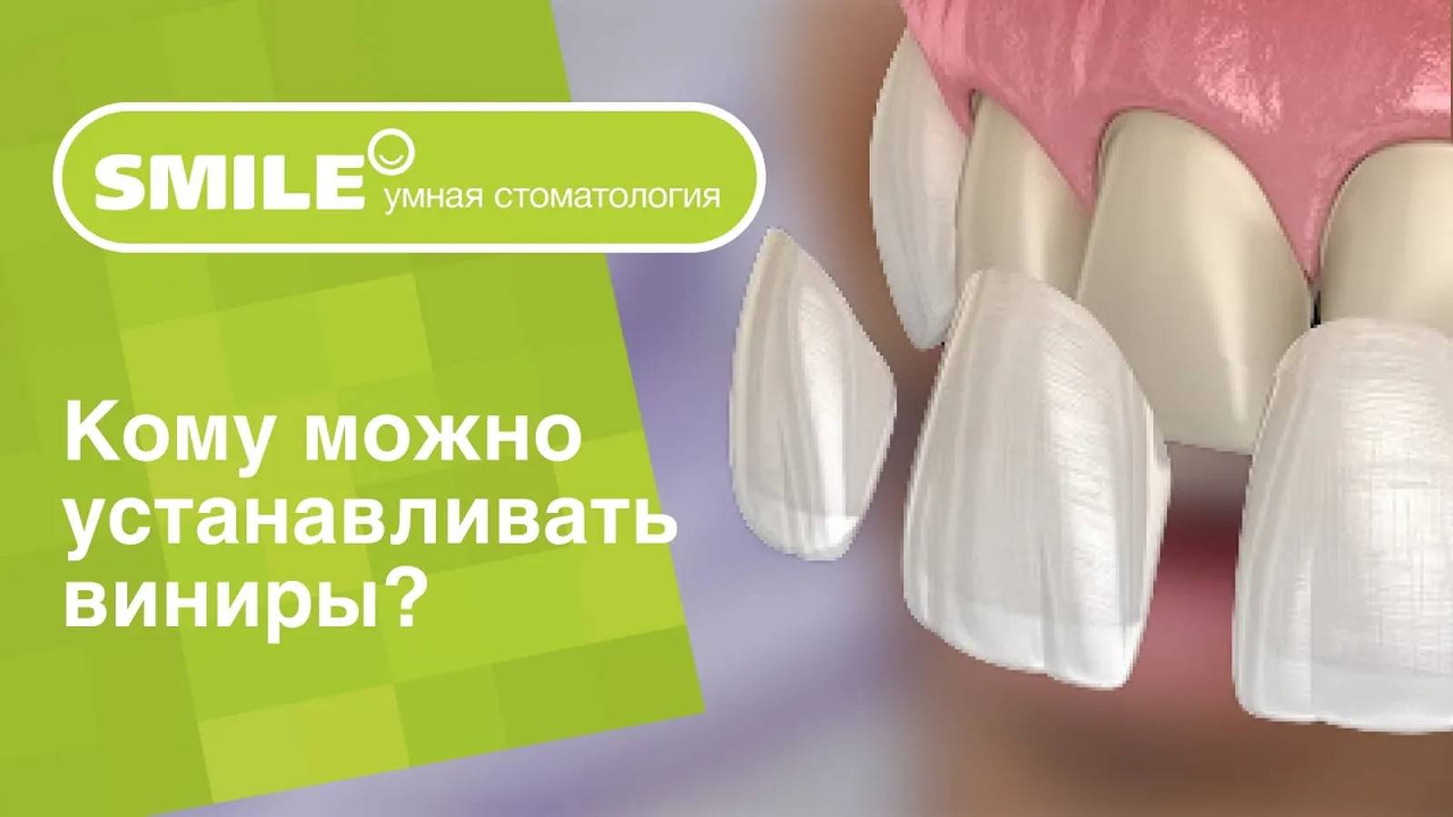 _🙋 Кому можно и кому нельзя устанавливать виниры_