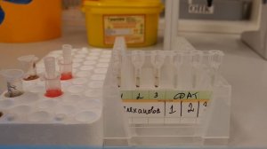 016. Прямая проба Кумбса. DAT. Практика. 07.03.2022 г.