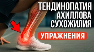 🔥 Тендинопатия ахилла: как вылечить? | Упражнения и рекомендации врача