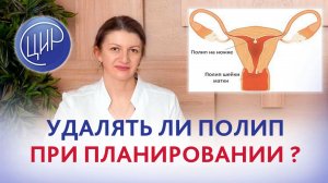 Полип в матке 10 мм. Надо ли удалять полип на ножке 10 мм. при планировании беременности?
