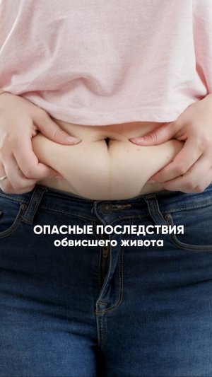 ОПАСНЫЕ последствия ОБВИСШЕГО живота! #упражнения #здоровье #молодость