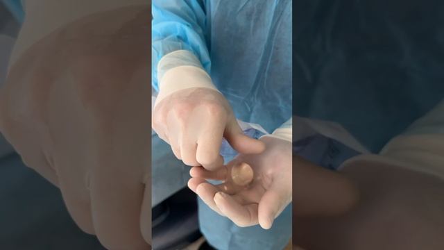 Операция по протезированию яичек смотреть онлайн