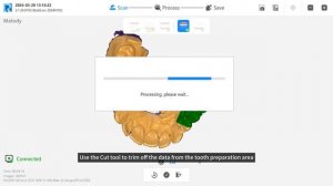 Интраоральный сканер Runyes IoS-11 – пример 3D-сканирования зубного ряда №3