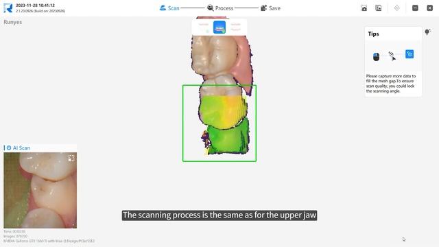 Интраоральный сканер Runyes IoS-11 – пример 3D-сканирования зубного ряда №2 смотреть онлайн