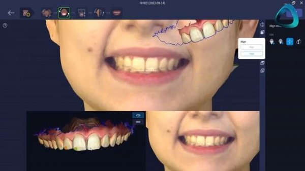 3D Desktop Face Scanner RAYFace Review The Future of Digital Dentistry iDD