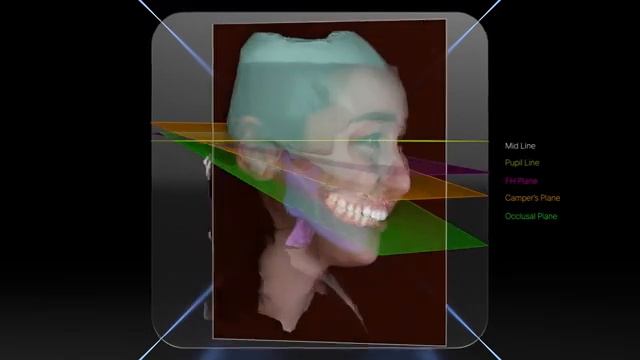 RAYFace 3D Facial Scanner смотреть онлайн