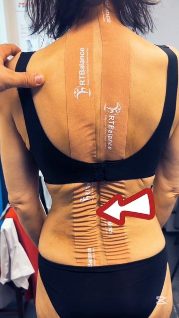 тейп - индикатор зажатых мышц в теле #RTBalance #АВАР #ВячеславРеут #тейп #больвспине #реабилитация смотреть онлайн