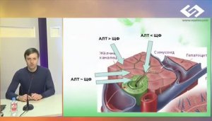 Синдром холестаза