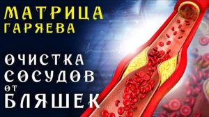 Матрица Гаряева ✨ Мощная Очистка Сосудов от Холестериновых Бляшек ☀️ Квантовое Очищение ❤️