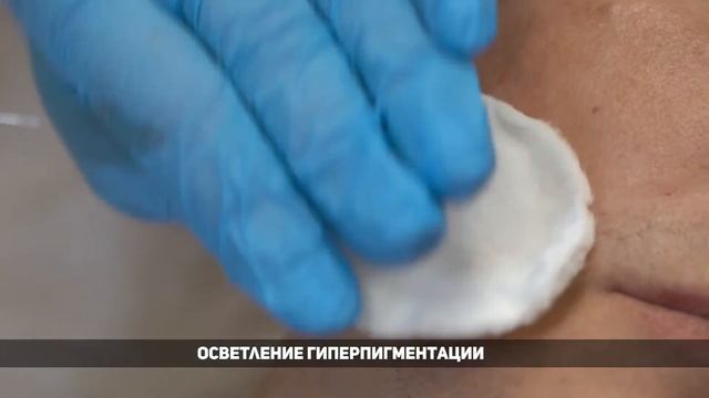 Преимущества биоревитализантов Revi