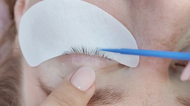 Подтяжка верхнего века