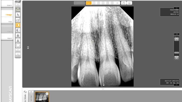 RIOSensor RIS500 визиограф смотреть онлайн