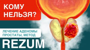 Основные противопоказания лечения аденомы простаты методом Rezum-терапии