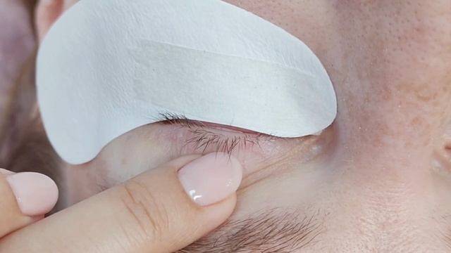 Установка патча и подклейки