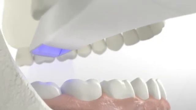 Ray Digital Solution SCAN смотреть онлайн