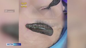 Новый тренд: в России катаракту начали лечить с помощью пиявок