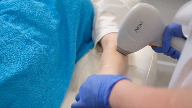 Лазерная эпиляция ALEX 755 нм смотреть онлайн