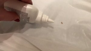 Как отстирать засохшую кровь с белого