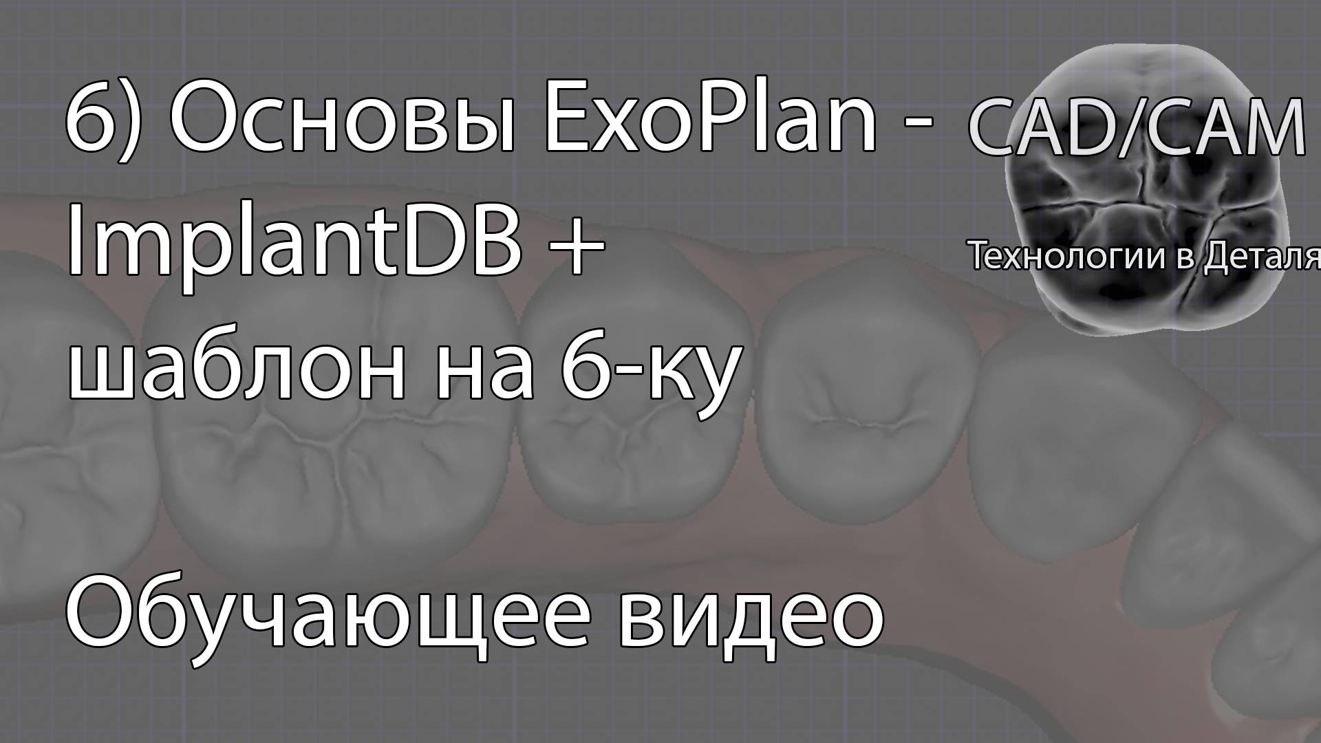 6) Основы ExoPlan - ImplantDB + шаблон на 6-ку смотреть онлайн