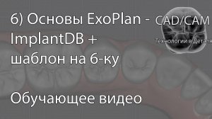 6) Основы ExoPlan - ImplantDB + шаблон на 6-ку