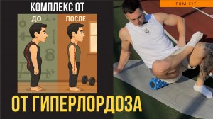 Как ИЗБАВИТЬСЯ от ГИПЕРЛОРДОЗА? Комплесный подход