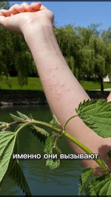 Почему крапива жалит?
