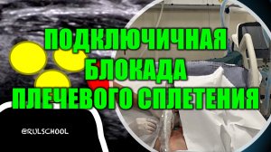 ПОДКЛЮЧИЧНАЯ БЛОКАДА ПЛЕЧЕВОГО СПЛЕТЕНИЯ
#painmanagment #узинавигация #regionalanesthesia #курсы