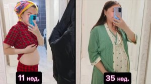 АСМР - Беременность и роды 👶 _ Болталка _ Шепот 💙