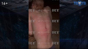 Отчим-садист издевался над ребёнком