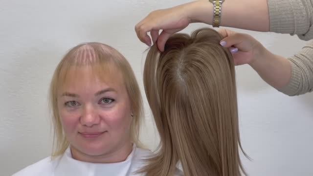 Наращивание волос при огромной алопеции