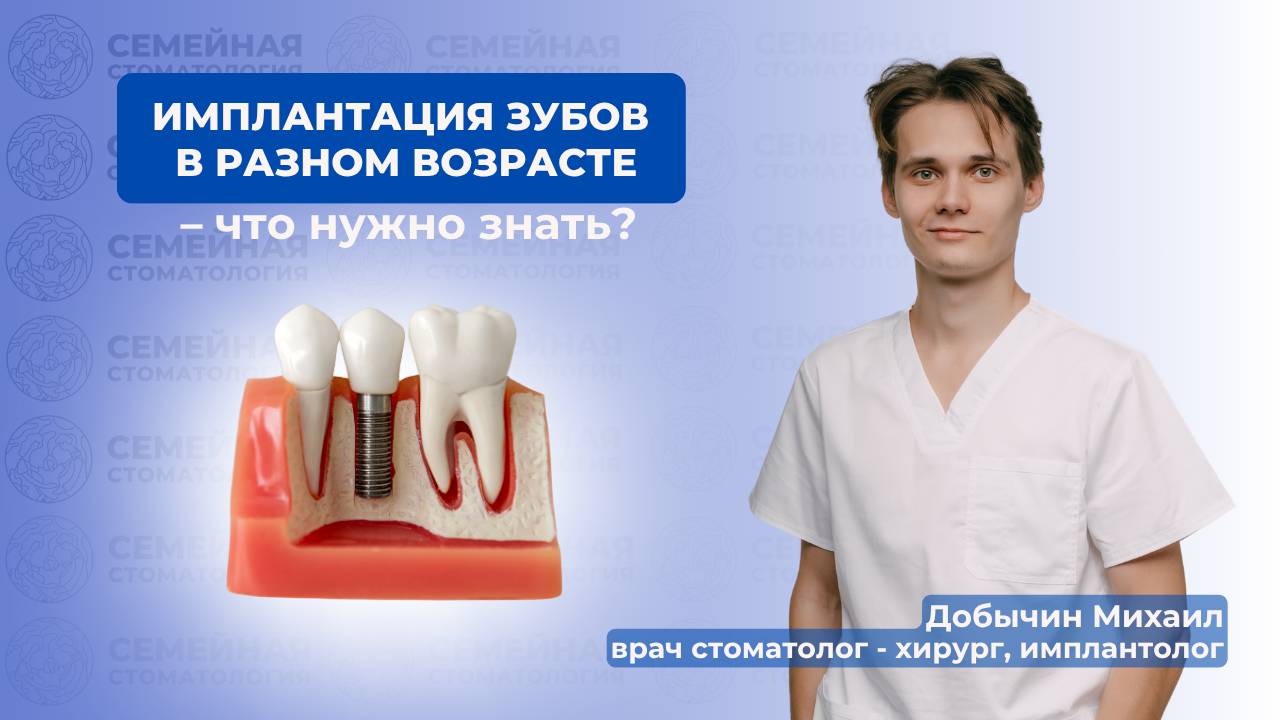Имплантация зубов в разном возрасте - что нужно знать? смотреть онлайн