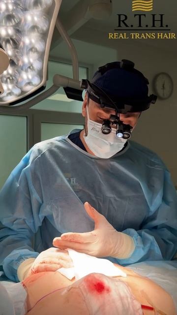 Подтяжка груди (Мастопексия) смотреть онлайн