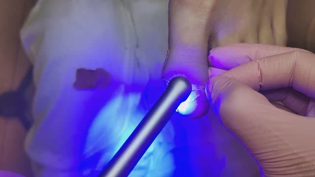 Титановая нить, коррекция, установка, для ногтей